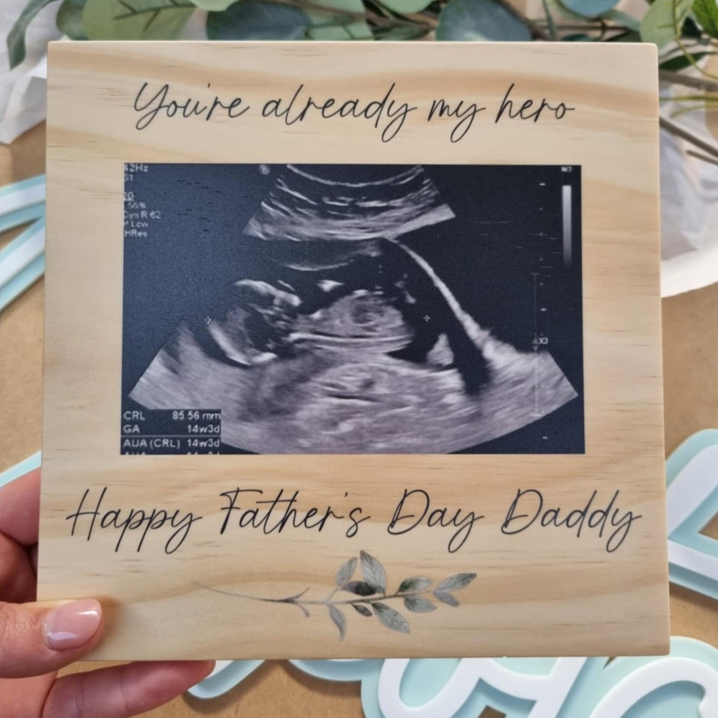 Wooden Photo Block - Ultrasound Photo Miss Ali's
